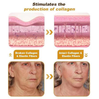 Botox Bee Venom Wrinkle Repair Ceam