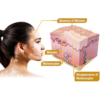 VitiGO" Revitalizing Bee Venom Cream – Natural Skin Restoration & Vitality