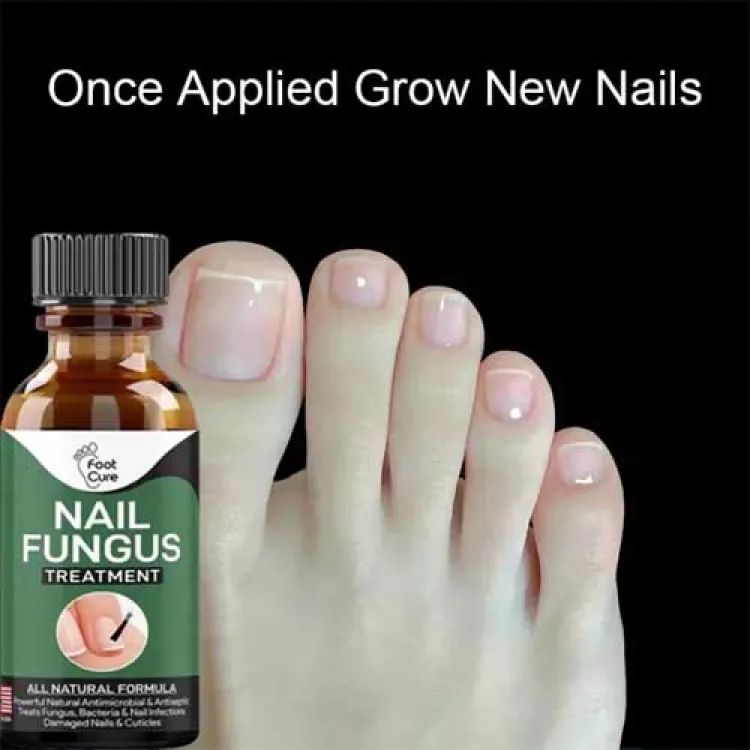 Nail Fungal Treatment Gel